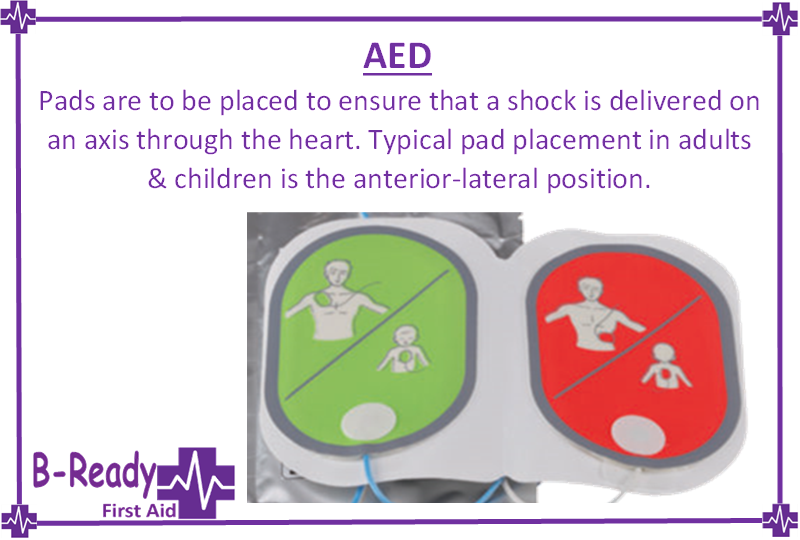 AED pad placement for children