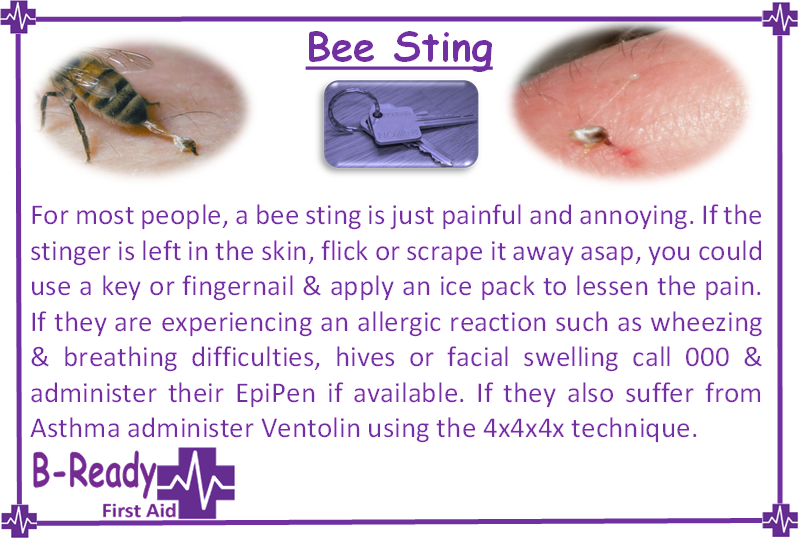 B-Ready First Aid information about bee stings management for First Aid