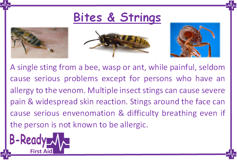 Bites & Stings in Australia, allergic reaction possible