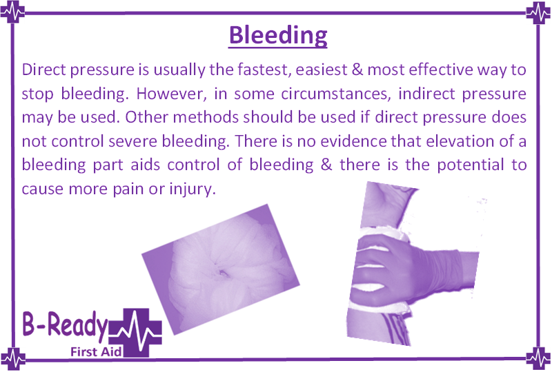 Picture to describe the use of pressure used on or around a bleed as First Aid management