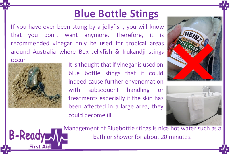 Picture about blue bottle sting management for First Aid