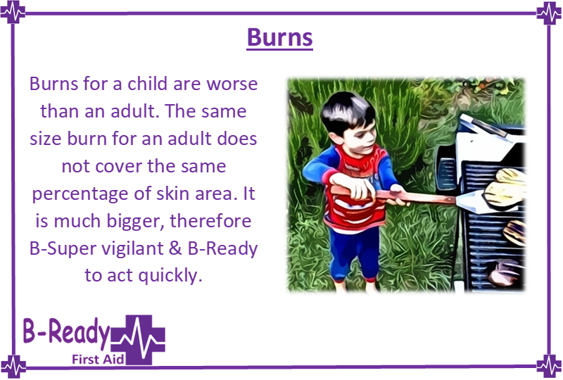 B-Ready First Aid info about children's burns