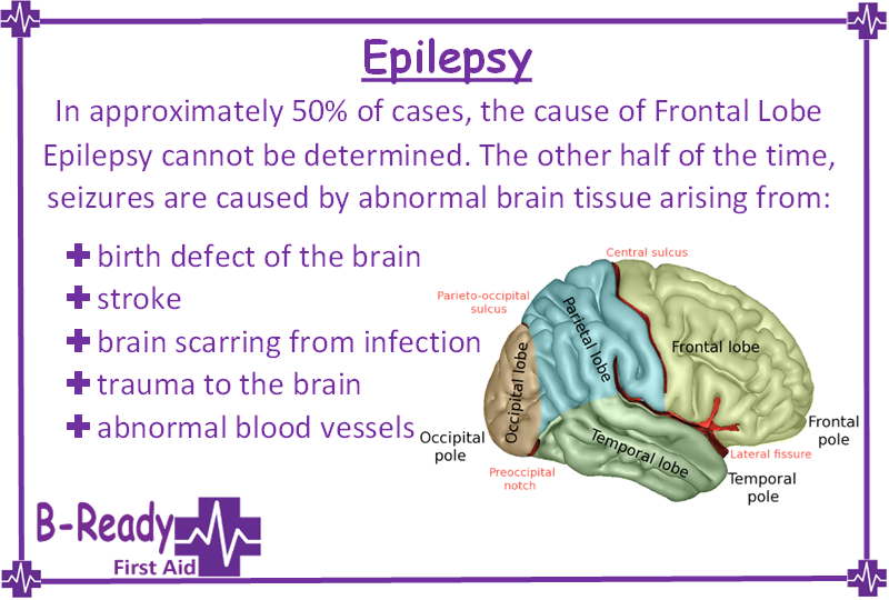 50% of Frontal lobe epilepsy cannot be determined & what the seizures may be caused from