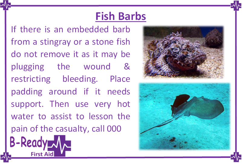 B-Ready First Aid infomation about  embedded fish barbs, First aid management