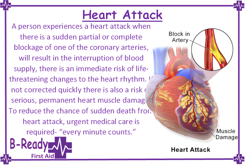Heart Attack info by B-Ready First Aid