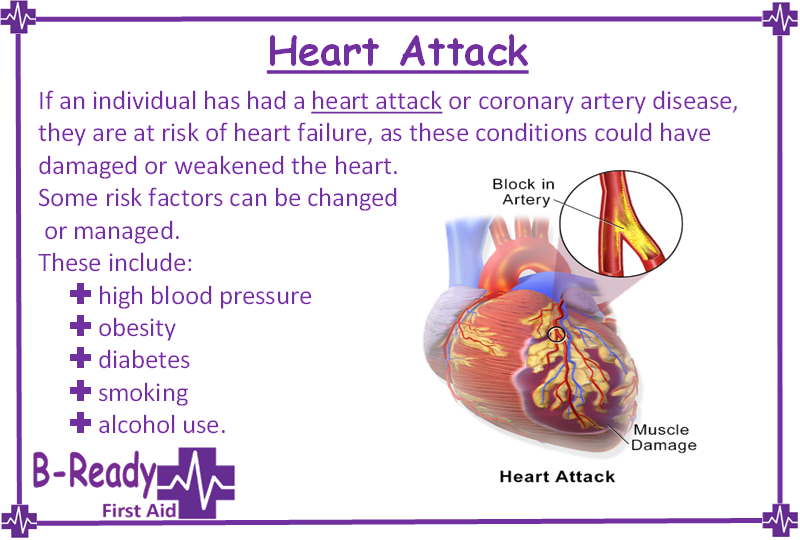 Heart attack and heart failure, know the signs & learn CPR