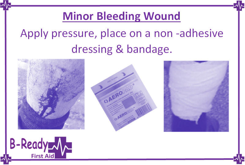 Minor bleeding wound management in a first aid emergency by B-Ready First Aid
