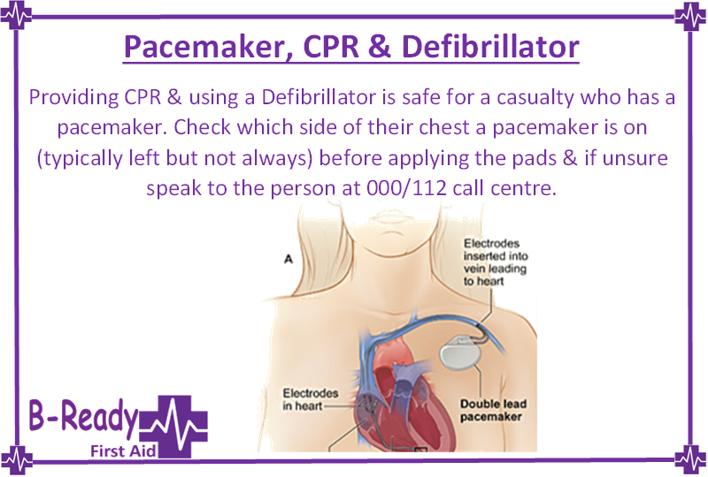 Pacemaker, CPR & Defibrillator information for Australia