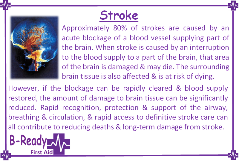 Stroke risks, learn First Aid to recognise ' FAST'!