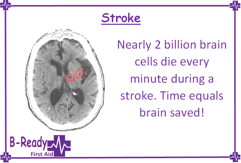 Stroke & First Aid knowledge imperative!